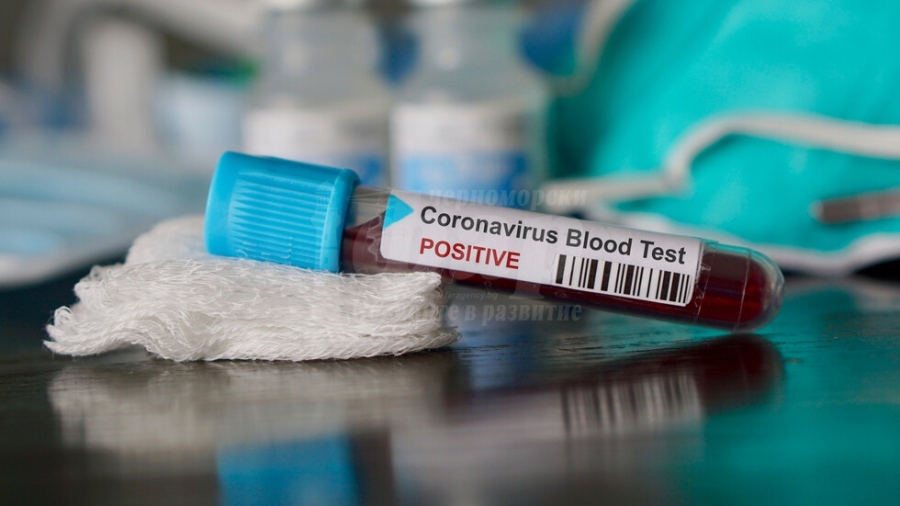 Община Бургас купува бързи и надеждни тестове за коронавирус
