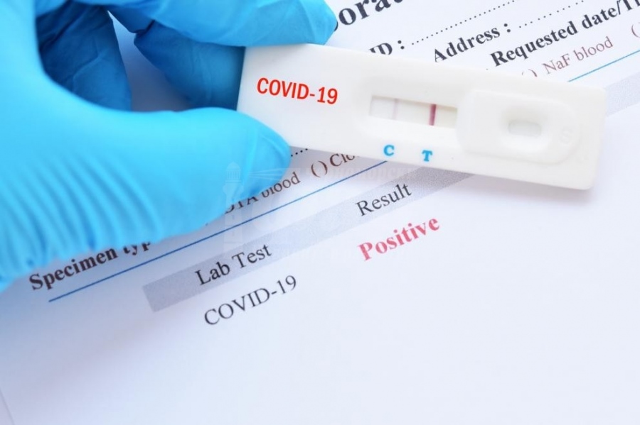83 са новите случаи на COVID-19 у нас