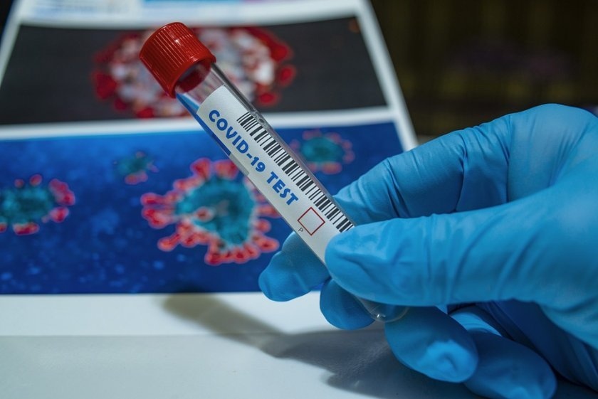 3568 новозаразени и 162 починали от коронавирус за последните 24 часа в страната