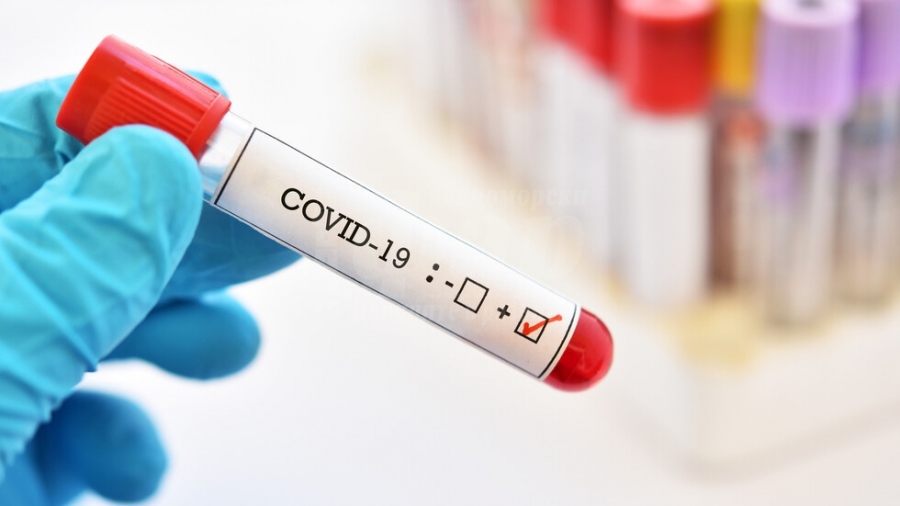 118 са новите случаи на коронавирус в Бургаска област