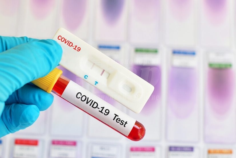 Рекорден брой нови случаи на COVID-19 за последното денонощие