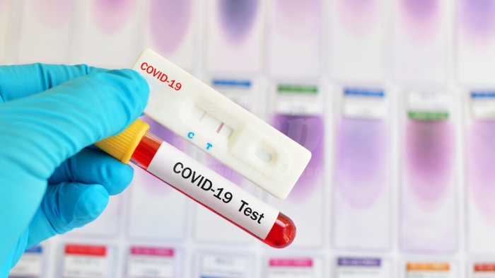  Професор: Тестовете за антитела могат да се фалшифицират много лесно