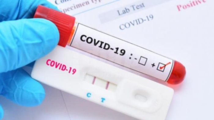Близо 500 са новите случаи на COVID-19 у нас